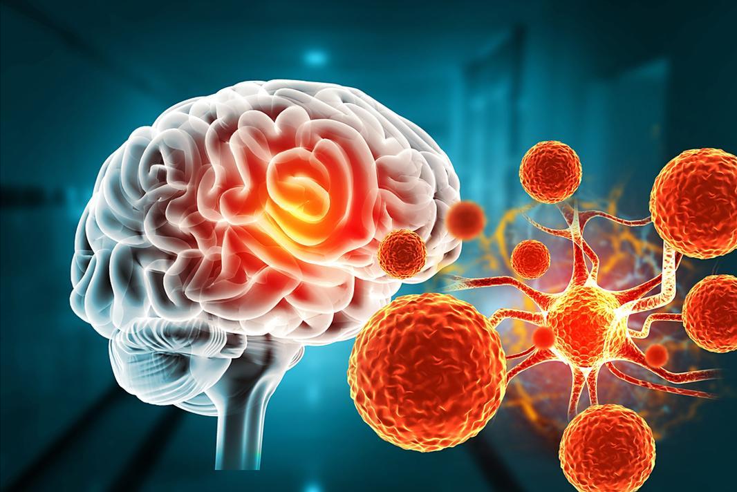 疫情爆发_尼帕病毒症状鉴别_尼帕病毒疫情